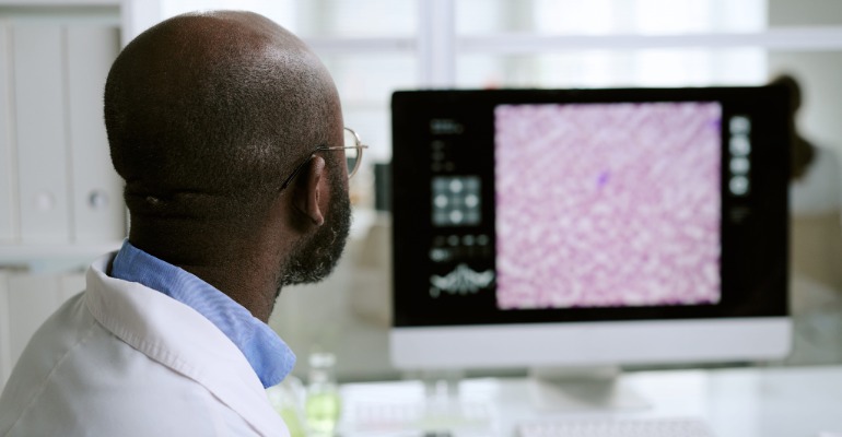 A.C.Camargo contribui para pesquisa que avalia menor toxicidade do everolimo sem perda de eficácia